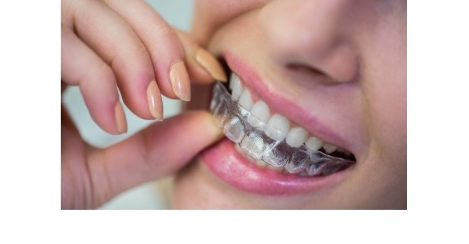 10 Best-Rated Dental Clinics in Abu Dhabi for Invisalign Treatments